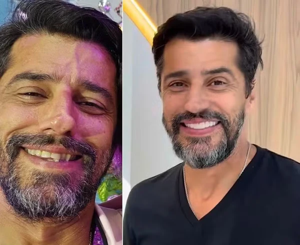 Alberto Cowboy coloca lente nos dentes por Reprodução
