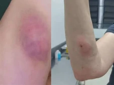 Imagem - Veterinária comete engano e aplica injeção em tutora e não em cachorra