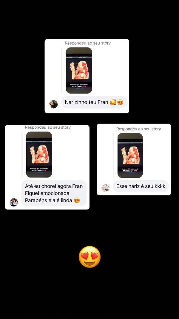 Franciny Ehlke mostra rosto da filha em ultrassom por Reprodução/Instagram