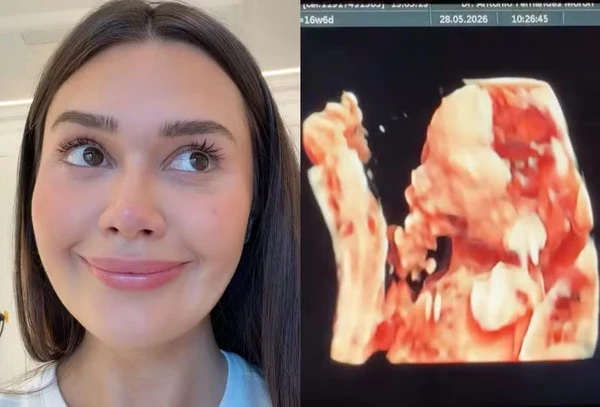 Franciny Ehlke mostra rosto da filha em ultrassom por Reprodução/Instagram