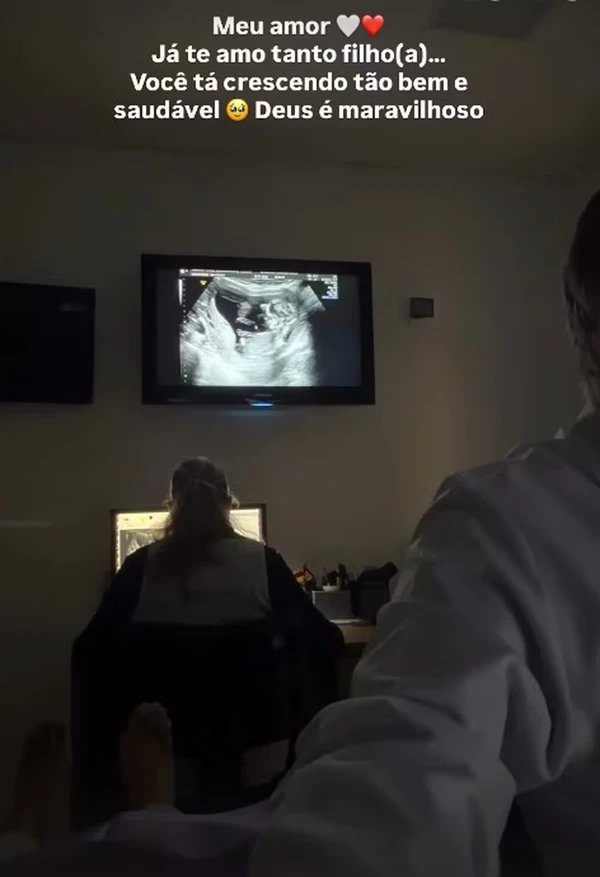 Franciny Ehlke mostra rosto da filha em ultrassom por Reprodução 
