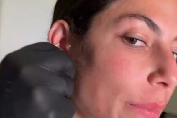 Mari Gonzalez exibe resultado de lobuloplastia por Reprodução/Instagram