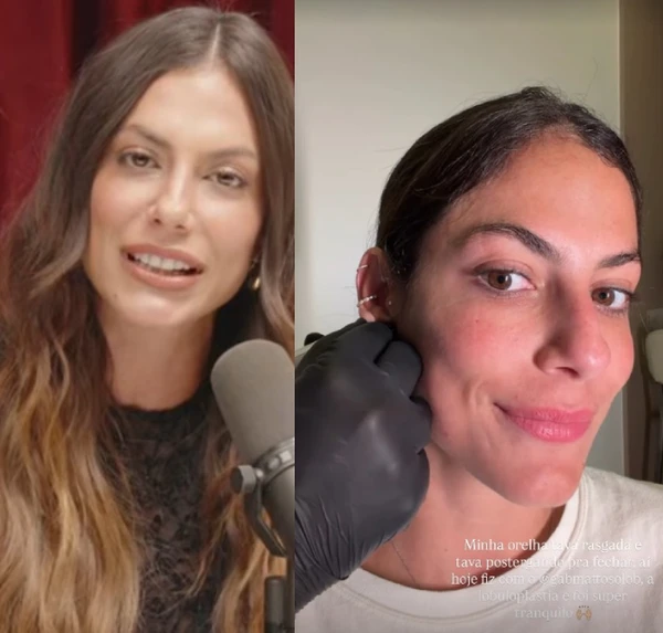 Mari Gonzalez exibe resultado de lobuloplastia por Reprodução/Instagram