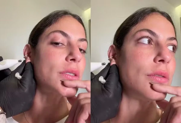 Mari Gonzalez exibe resultado de lobuloplastia por Reprodução/Instagram