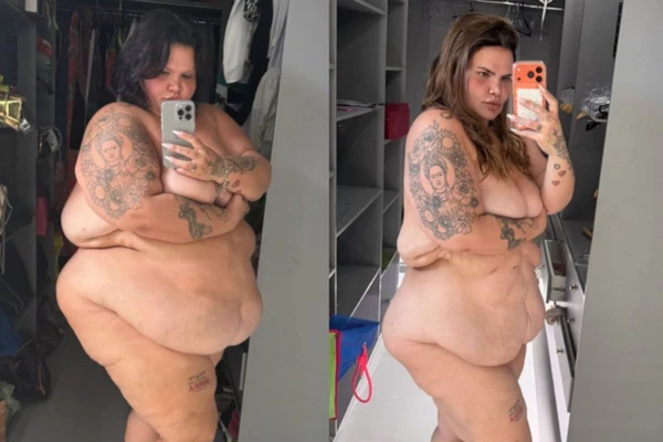 Thais Carla mostra execesso de pele após perda de peso