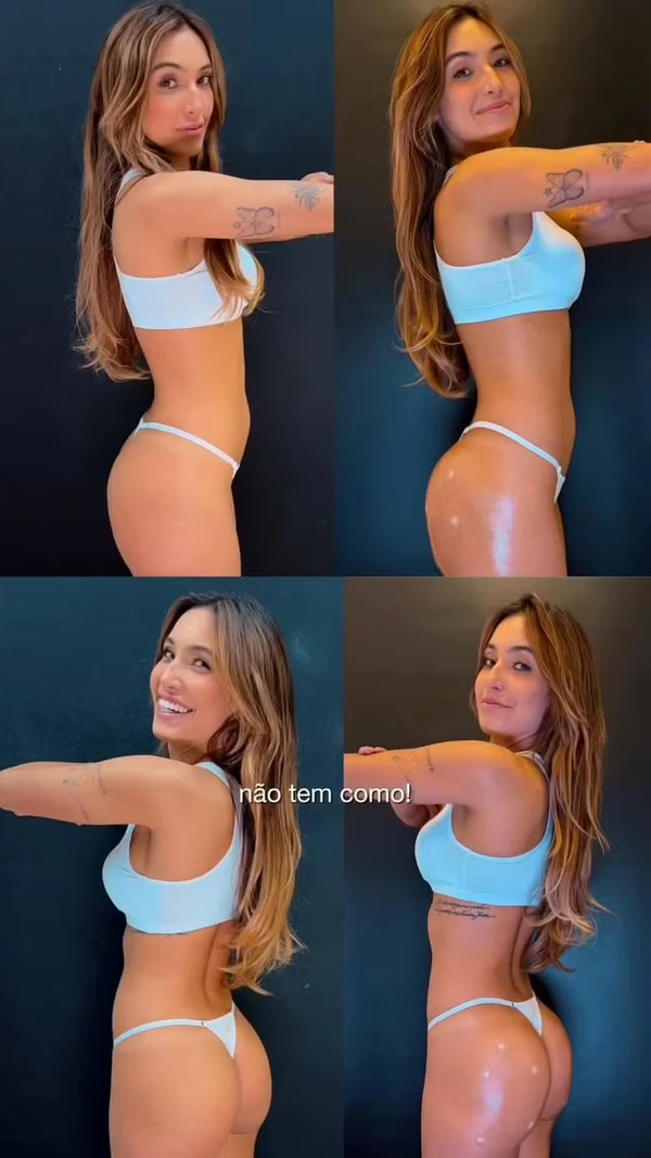 Vanessa Lopes: antes e depois do tratamento por Reprodução/Instagram