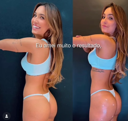 Vanessa Lopes: antes e depois do tratamento por Reprodução/Instagram