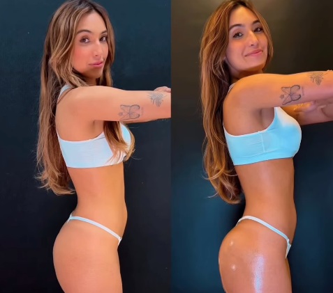 Vanessa Lopes: antes e depois do tratamento por Reprodução/Instagram