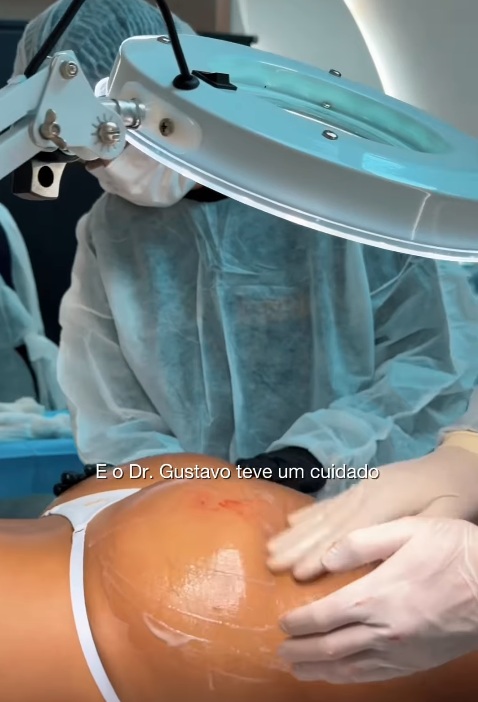 Vanessa Lopes passou por harmonização no bumbum por Reprodução/Instagram