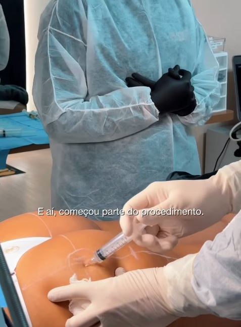 Vanessa Lopes passou por harmonização no bumbum por Reprodução/Instagram