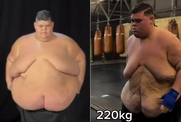 Gordão da XJ antes (350 kg) e depois (220 kg) de perder 120 kg por Reprodução/Instagram