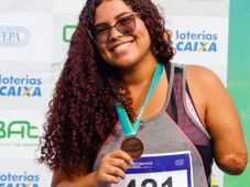 Imagem - Justiça nega indenização a jovem que perdeu braço em ataque de tubarão em praia do Nordeste e diz que vítima 'assumiu risco'