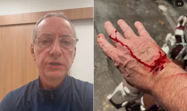Apresentador da Globo é atacado por pitbull: ‘Ele avançou e feriu a mim e a uma das minhas cachorras’ por Reprodução