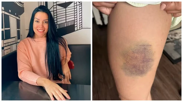 Nutricionista que escapou de estupro com um mata-leão revela como uma aula de defesa pessoal ajudou a salvar sua vida por Reprodução