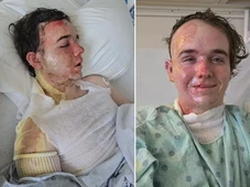 Imagem - Funcionário sofre queimaduras graves ao ser atacado por colega com óleo fervente dentro de McDonald's