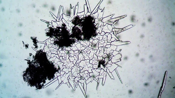 Ao microscópio, hifas e esporos revelam a estrutura dos fungos, organismos que absorvem nutrientes do ambiente em que vivem por turek / Pexels