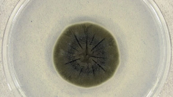 Estes são os fungos melanizados, eles incluem algumas espécies, como Cryptococcus neoformans, Wangiella/Exophiala dermatitidis, Cladosporium sphaerospermum e Cladosporium cladosporioides por Medmyco / Wikimedia Commons