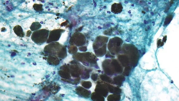 O principal mecanismo utilizado por esses seres é uma camada de melanina capaz de interagir com a radiação do ambiente por Nephron / Wikimedia Commons