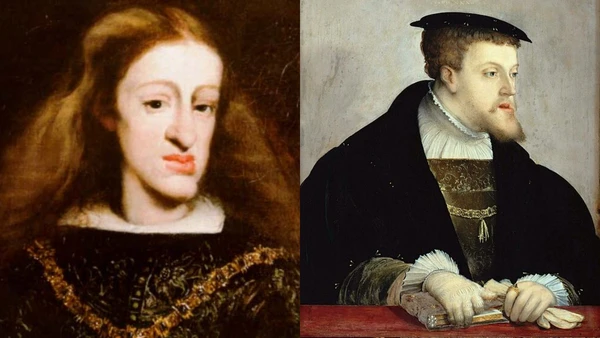 Um dos casos mais famosos de problemas genéticos derivados de incesto (endogamia) é a Casa de Habsburgo. Uma família real que teve como marca registrada o prognatismo mandibular